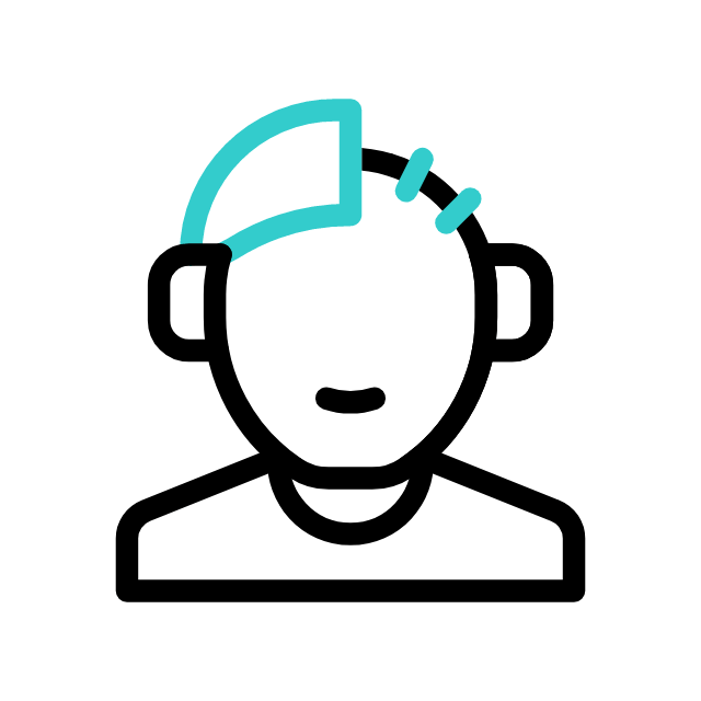 Hair Transplant Icon